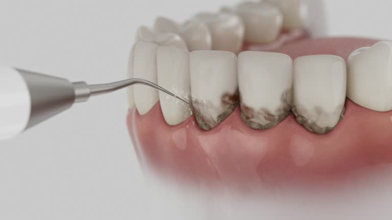 Trusted Tooth Extraction service in Hamlet, NC - Dentist Open Now